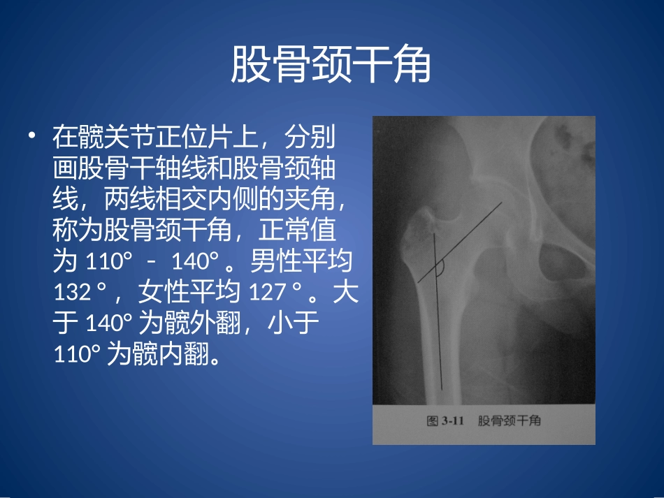 髋关节X光片角度测量_第2页