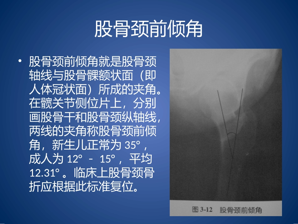 髋关节X光片角度测量_第3页