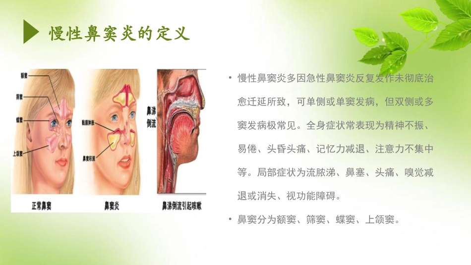慢性鼻窦炎护理查房_第3页