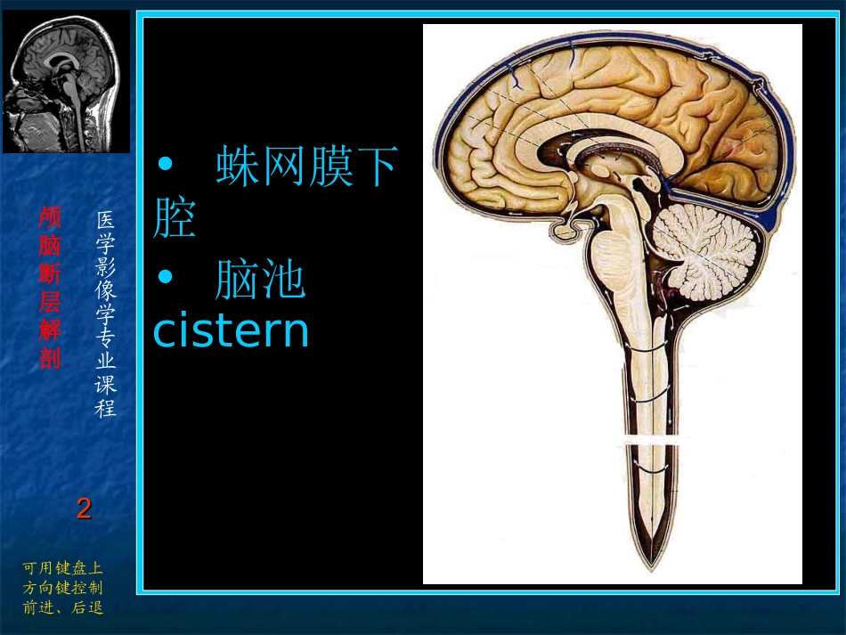 脑池CT影像解剖_第2页
