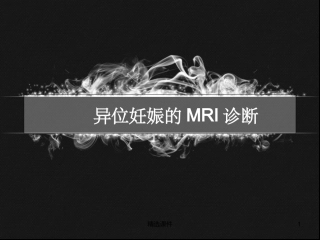 内耳畸形CT