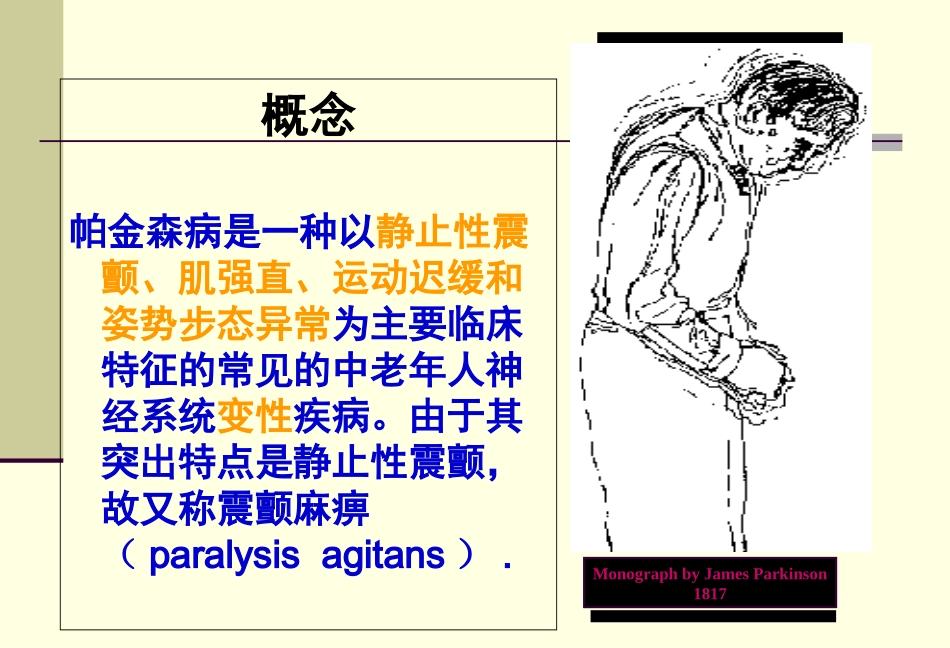 帕金森病护理常规优质课件_第3页