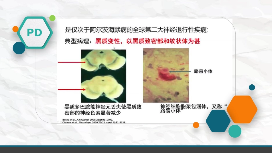 帕金森病药物治疗课件_第3页