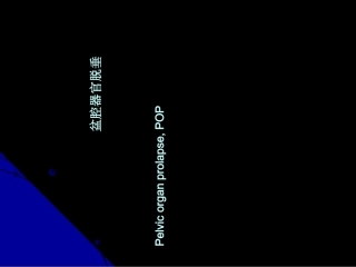 盆腔器官脱垂