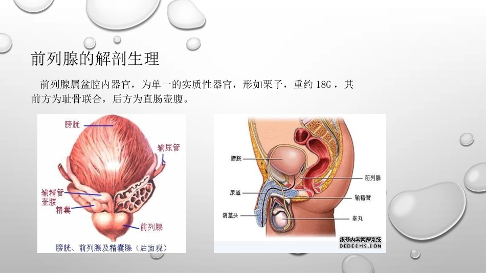 前列腺癌的护理._第3页