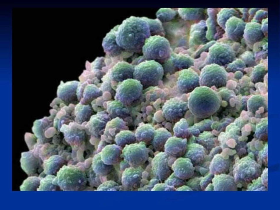 前列腺癌优质课件_第1页