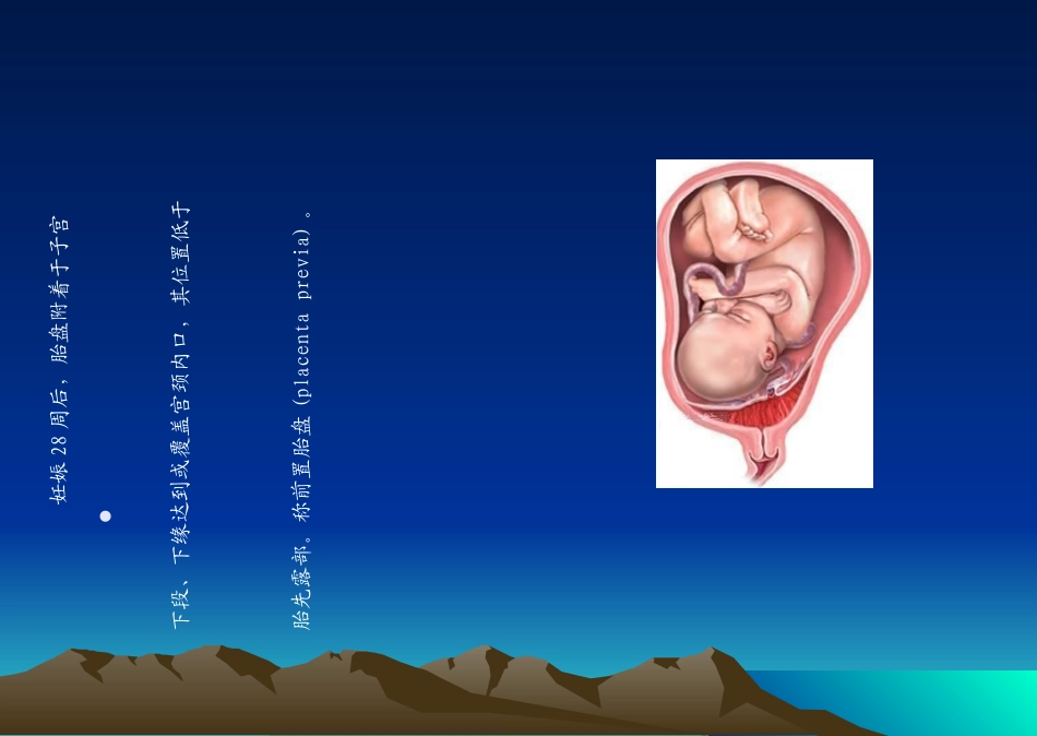 前置胎盘教学查房_第2页
