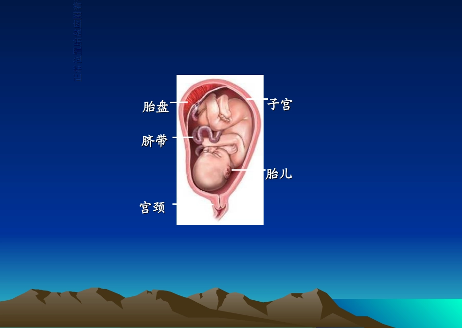 前置胎盘教学查房_第3页