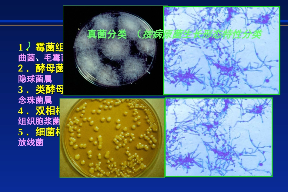 侵袭性真菌感染优质课件_第2页