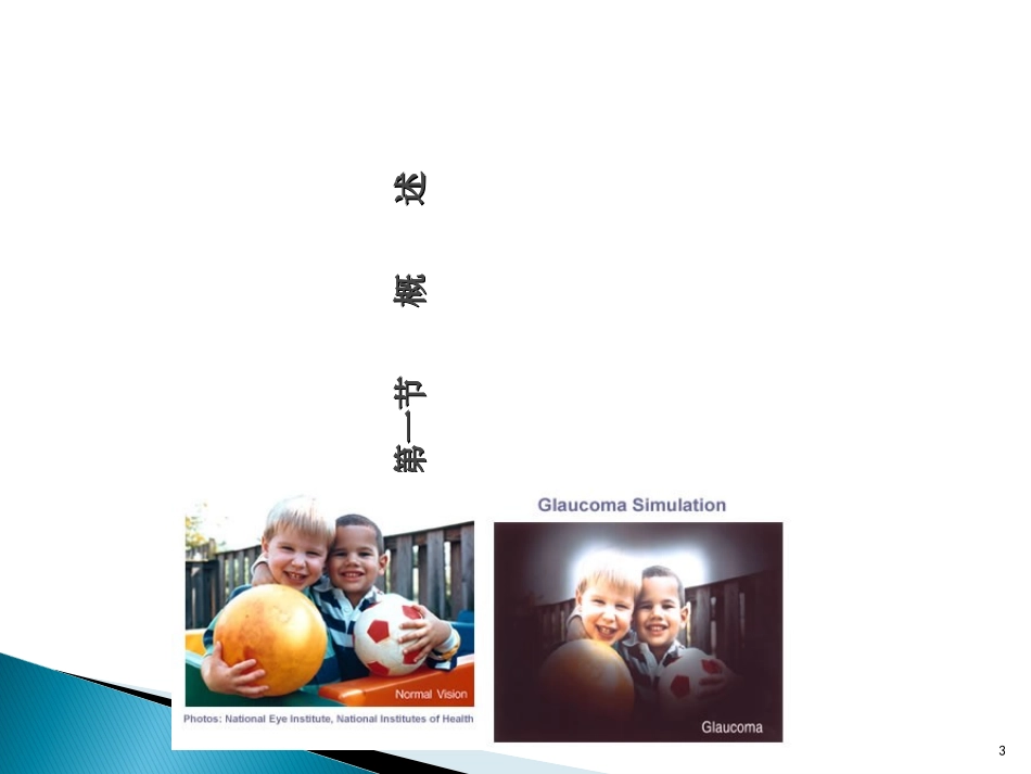 青光眼优质课件_第3页