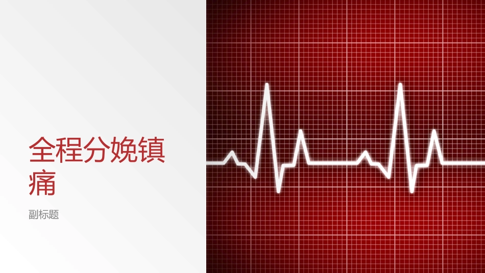 全程分娩镇痛_第1页