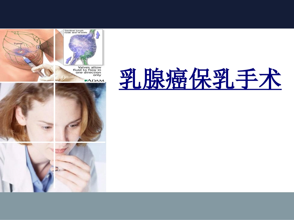 乳腺癌保乳手术优质课件_第1页