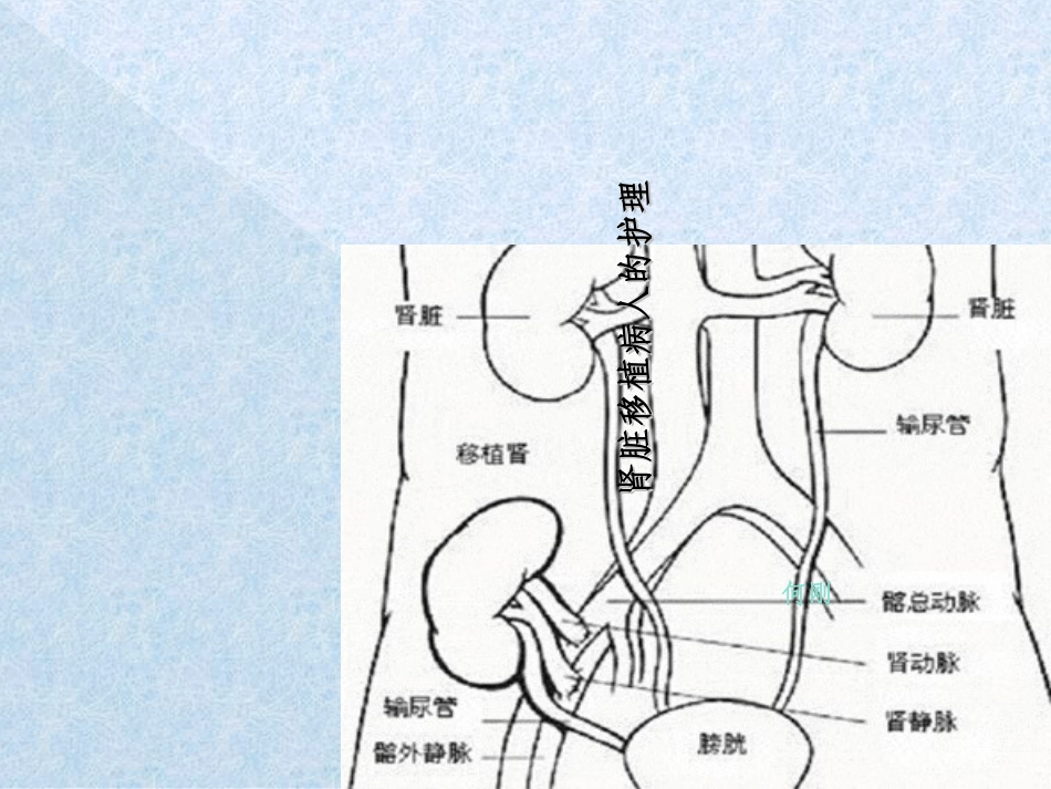 肾移植的护理_第1页