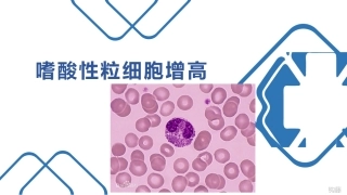 嗜酸性粒细胞增多性疾病