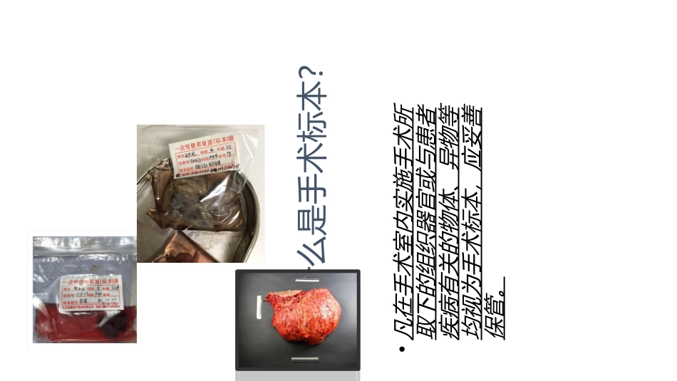 手术标本的管理优质课件_第3页