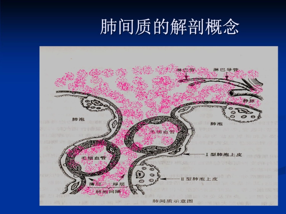 特发性肺纤维化_第3页