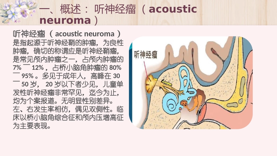 听神经瘤的护理查房课堂_第3页