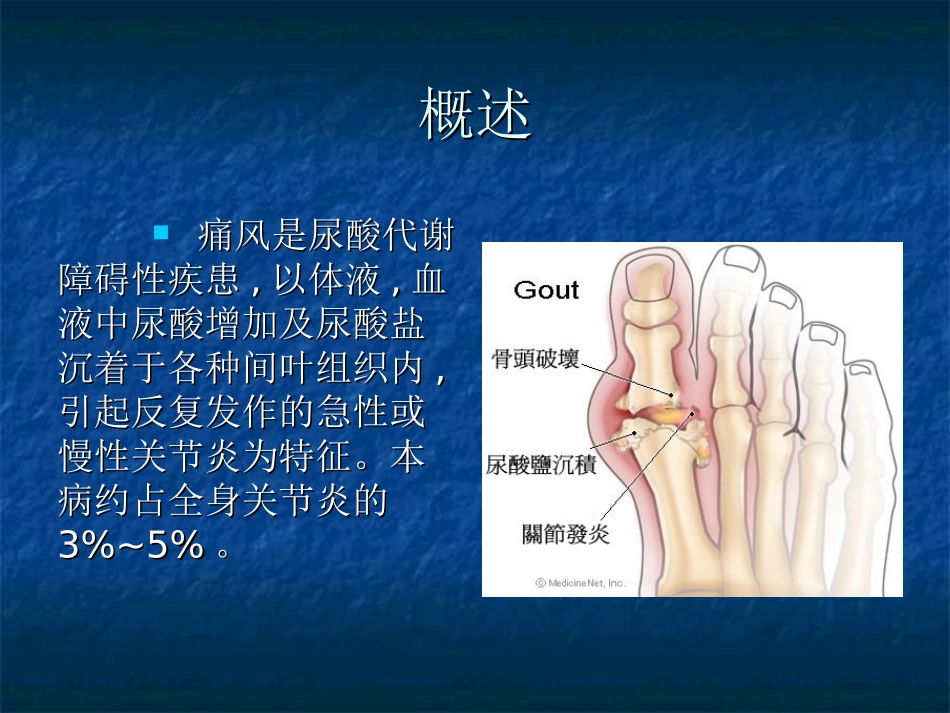 痛风性关节炎优质课件_第2页