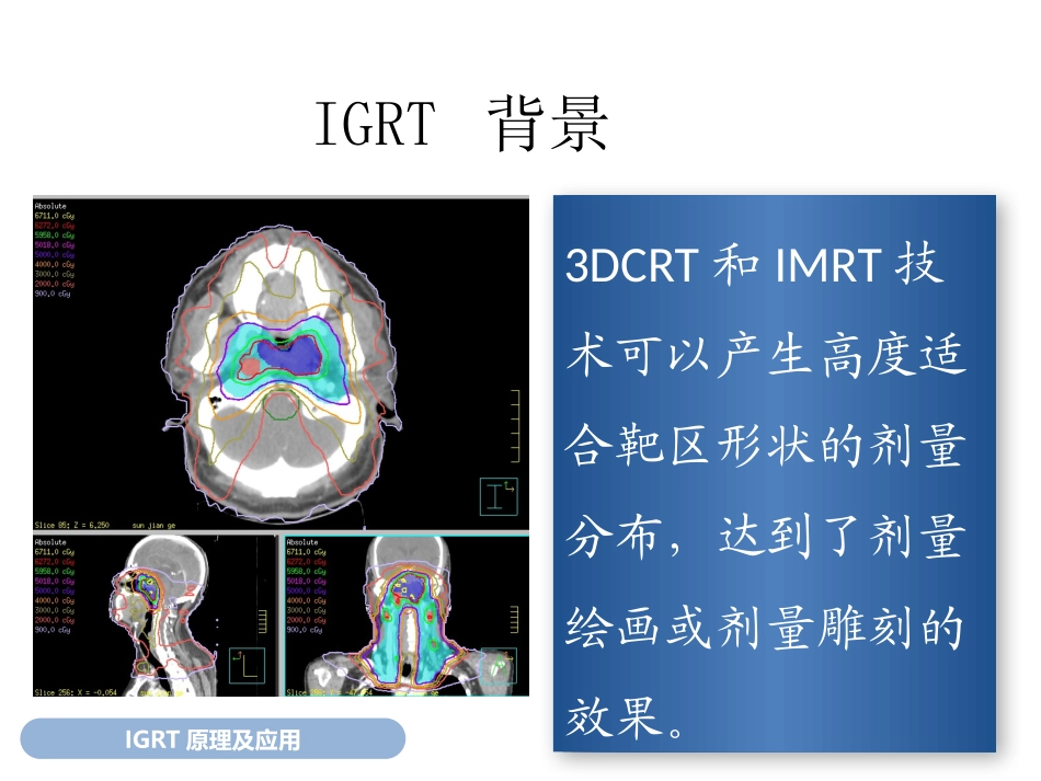 图像引导放疗原理应用和QA优质课件_第3页