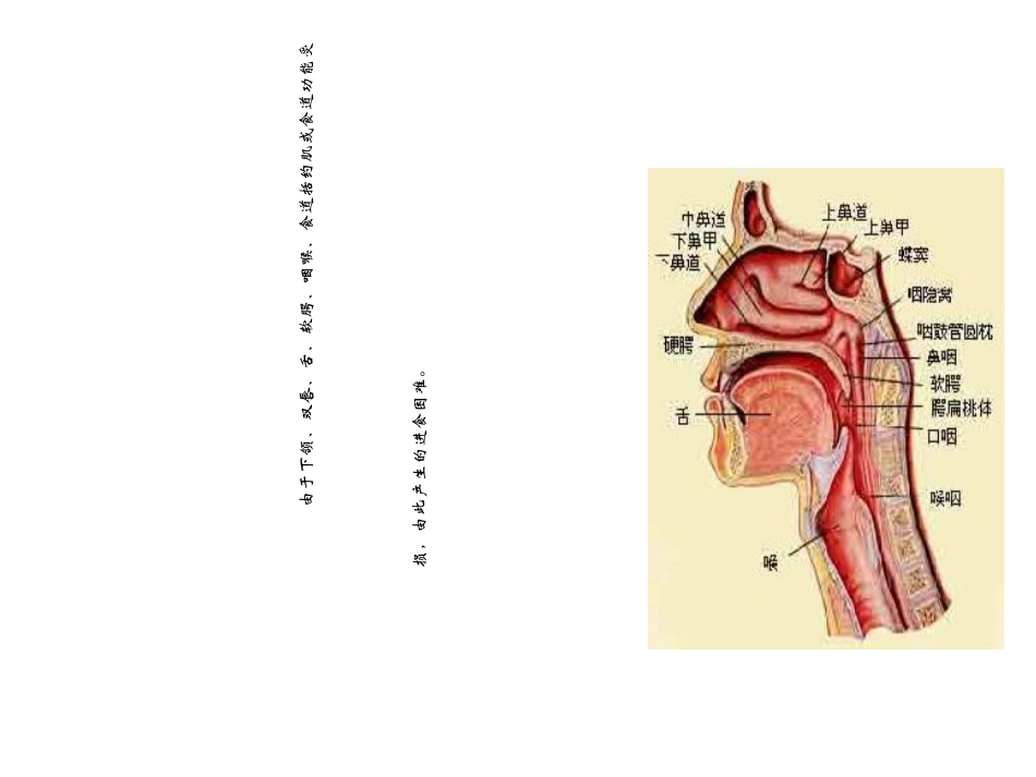吞咽困难课件_第2页