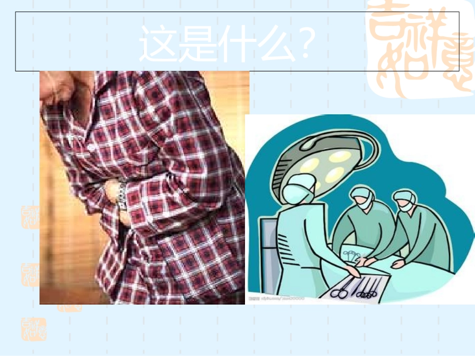 外科急腹症的诊断鉴别诊断及处理原则课件_第3页