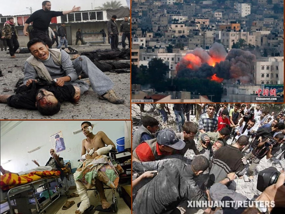 外伤急救课件_第2页