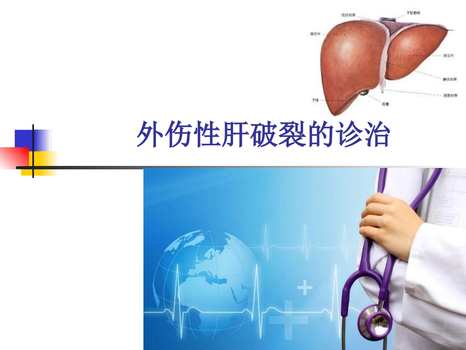 外伤性肝破裂的诊治_第1页