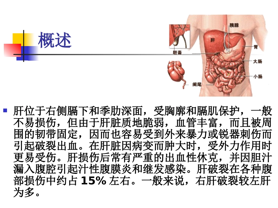 外伤性肝破裂的诊治_第2页