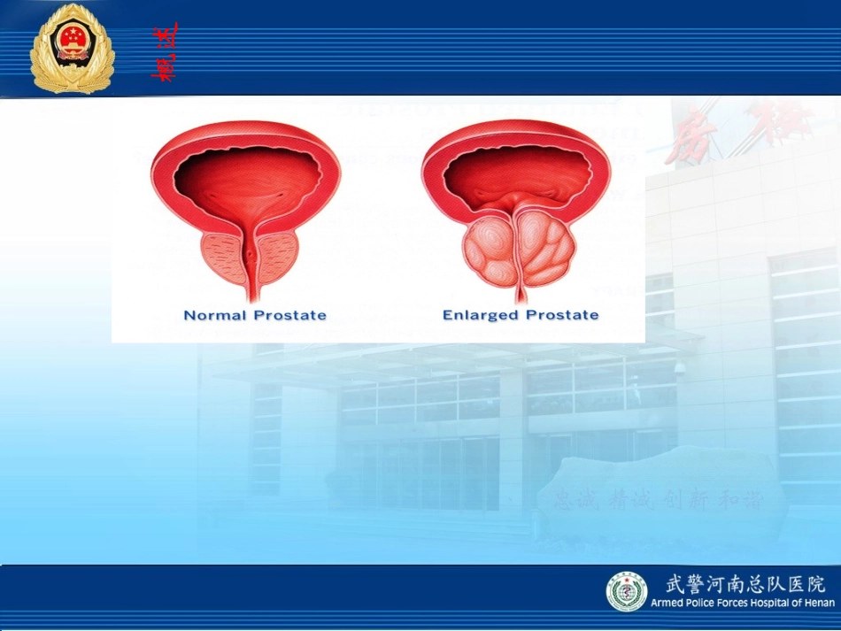 微拉激光课件_第3页