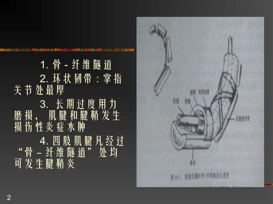 狭窄性腱鞘炎课件_第2页