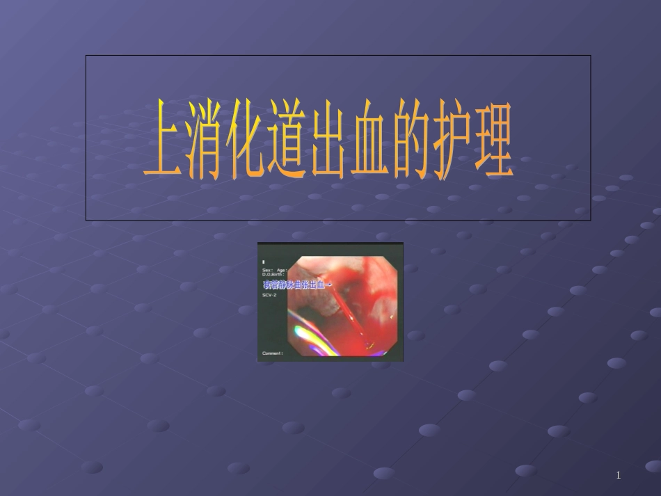 消化道出血的护理要点课件_第1页