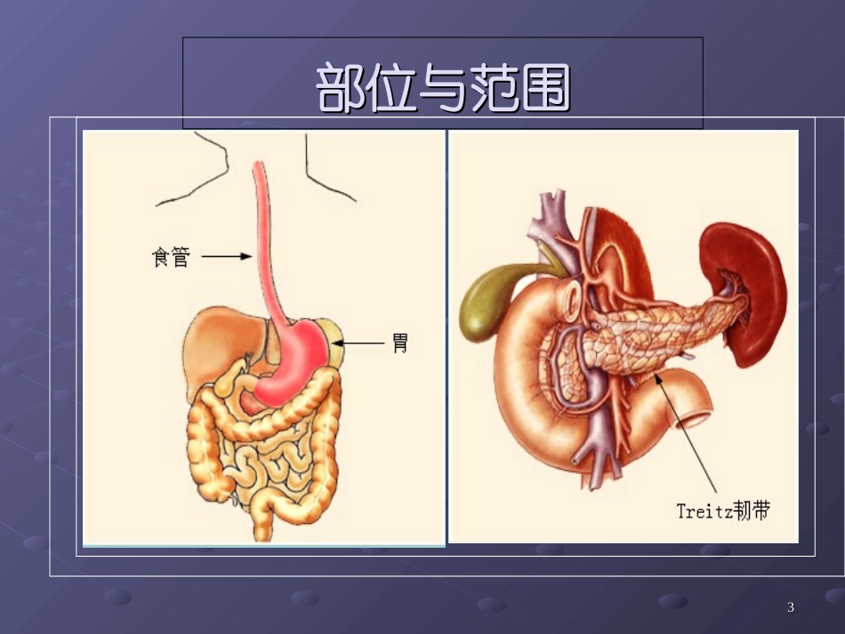 消化道出血的护理要点课件_第3页
