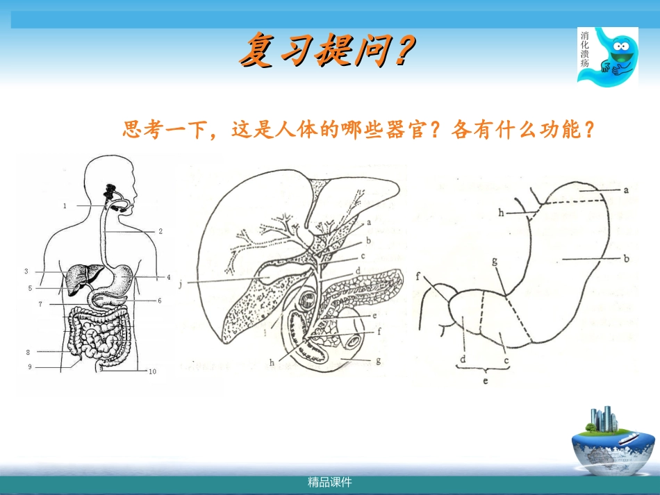 消化性溃疡病人的护理评估讲座_第2页