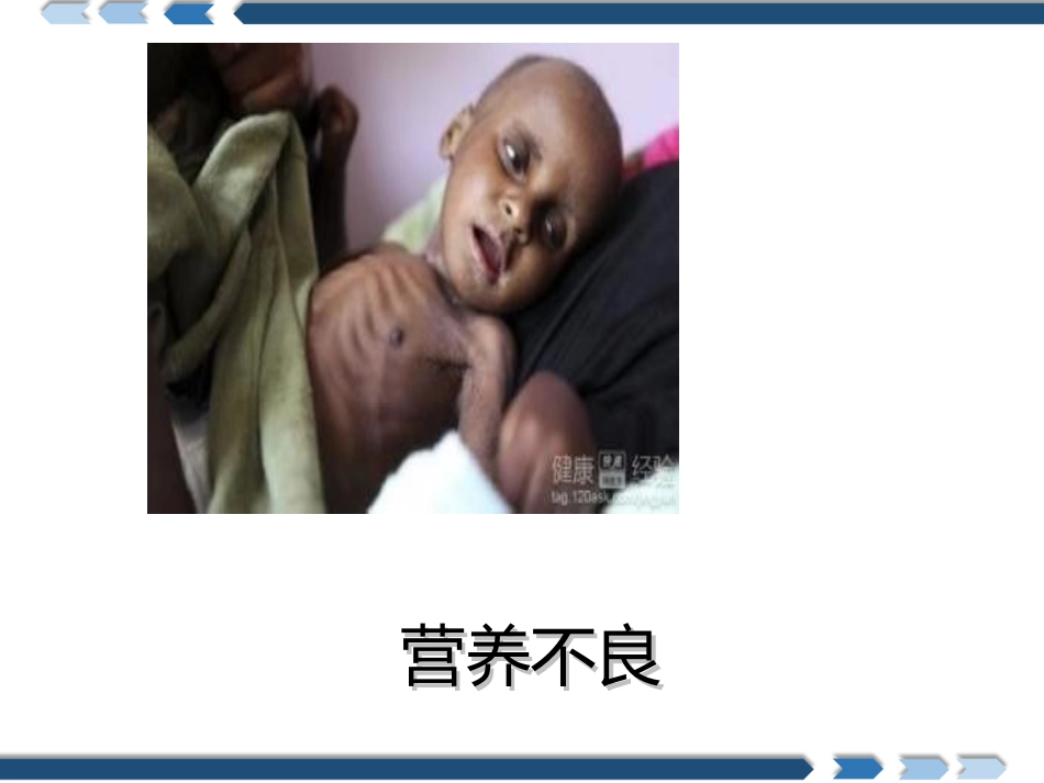 小学三四年级体育和健康营养不良和肥胖_第2页