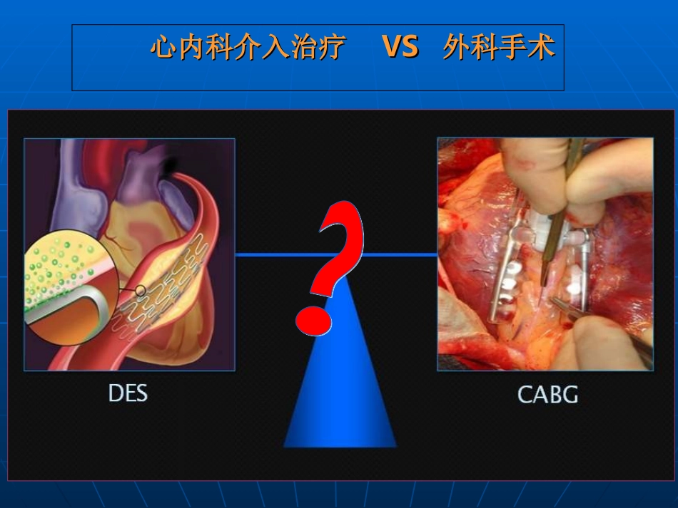 心脏介入治疗的简介优质课件_第3页