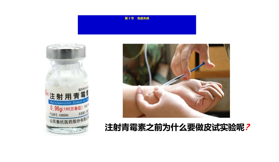 新教材免疫失调课件生物人教版选择性必修一_第2页