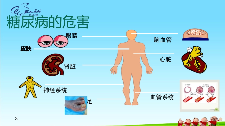 新糖尿病眼部并发症_第3页