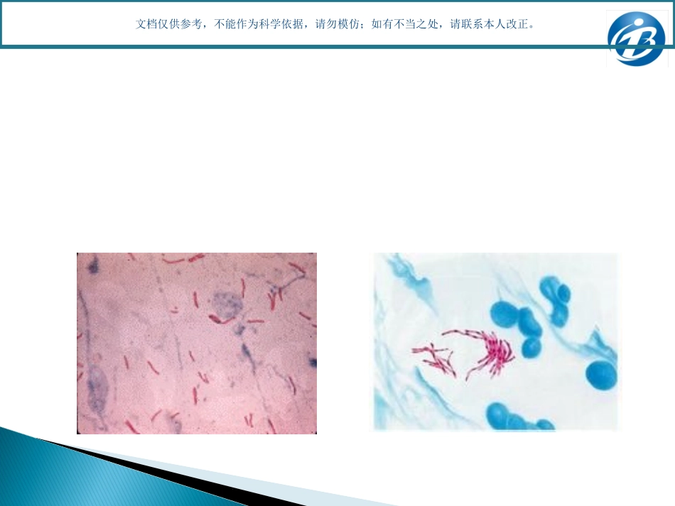 学校结核病防控知识学生篇课件_第2页