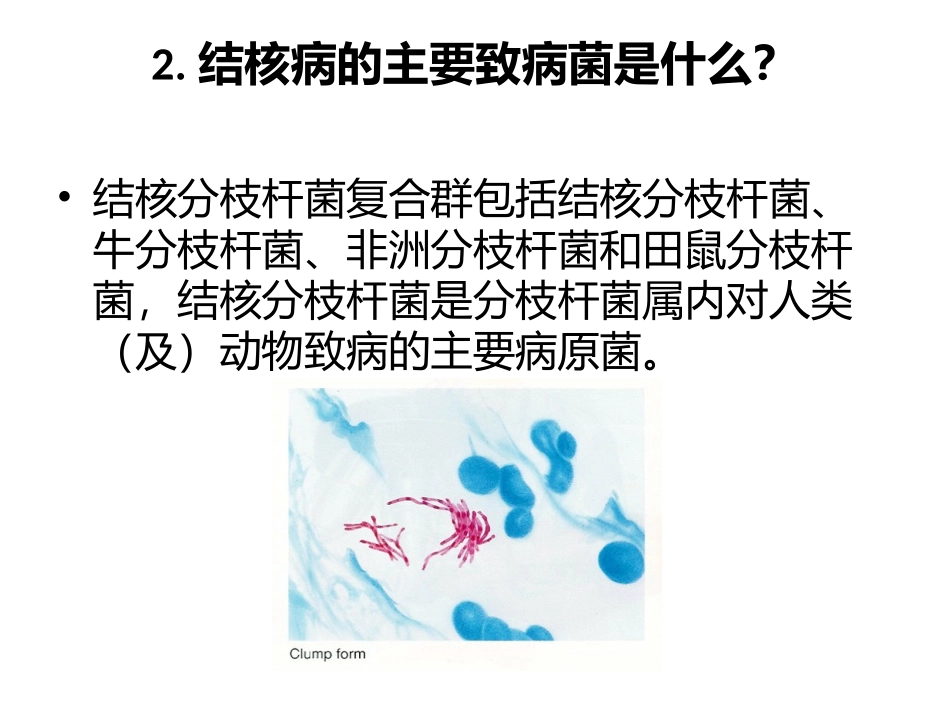 学校结核病防治知识_第3页