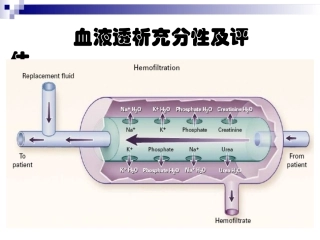 血液透析充分性