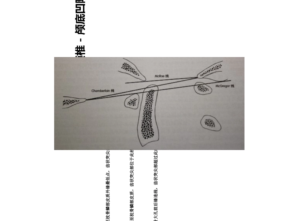 医学脊柱相关生物力线X线测量专题培训课件_第3页