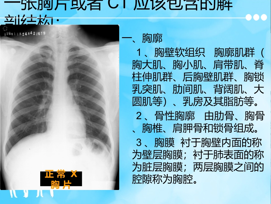 医学胸片及胸部CT的阅读内容及肺段定位培训课件_第2页