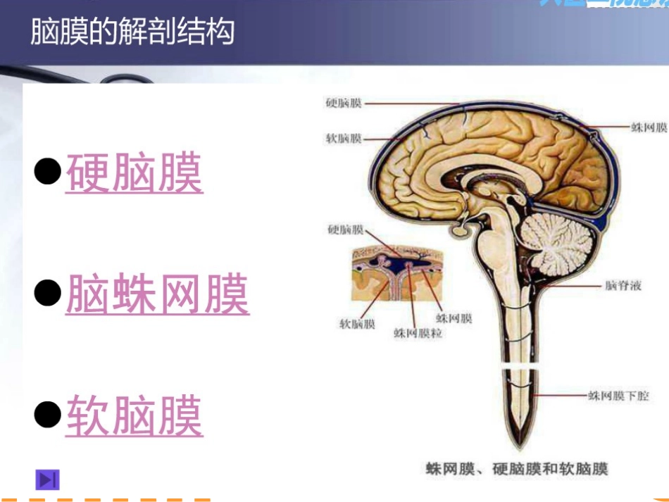 硬膜下出血及硬膜外出血区别优质课件_第3页