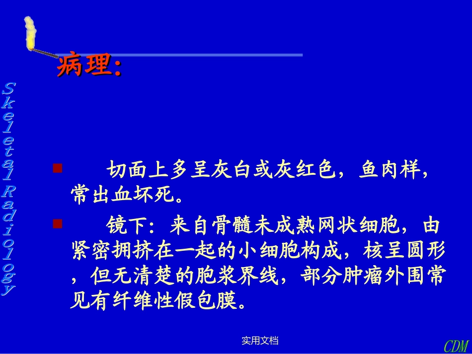 尤文肉瘤影像诊断_第3页