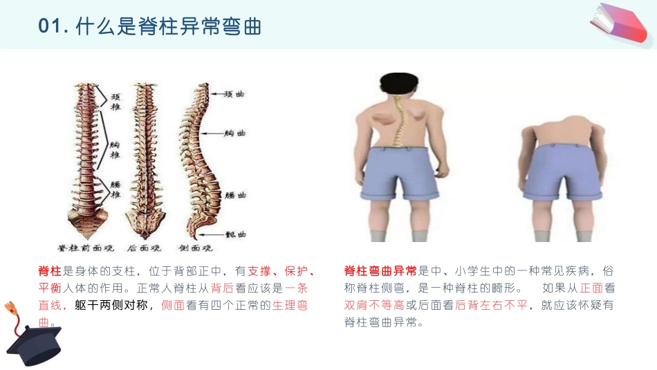 预防脊柱异常弯曲_第3页