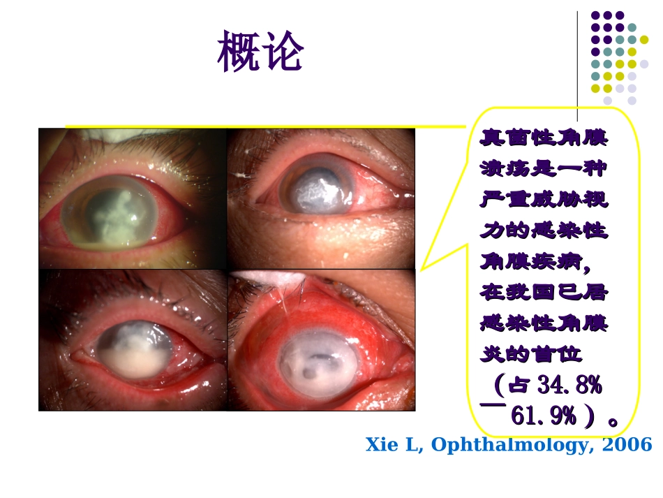 真菌性角膜炎_第2页
