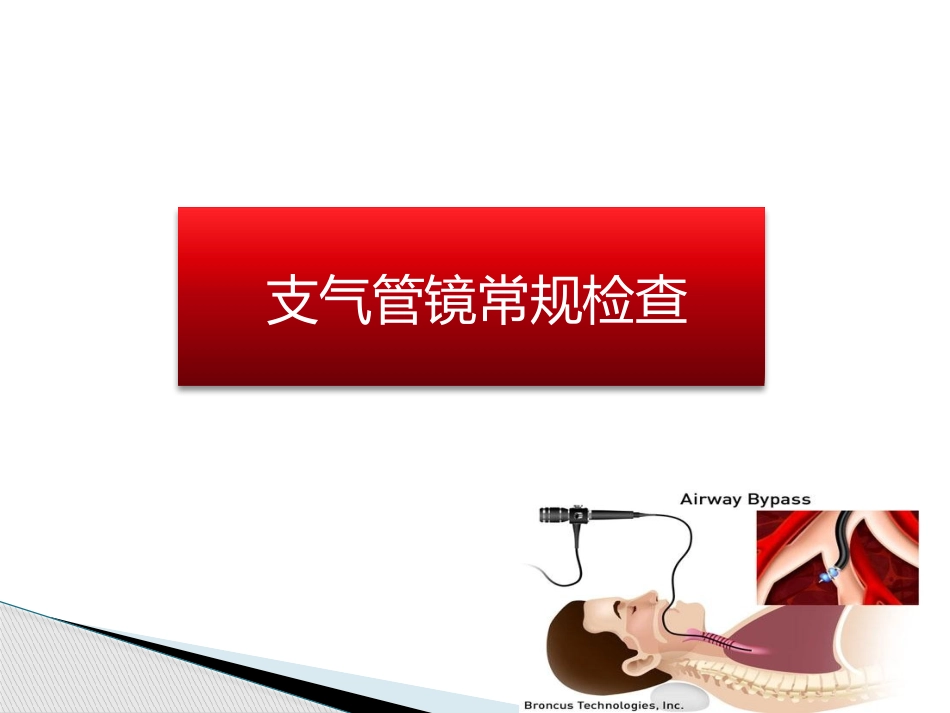 支气管镜介入治疗讲课优质课件_第2页