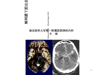 蛛网膜下腔出血教案