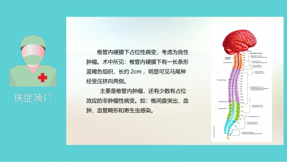 椎管内占位课件_第2页