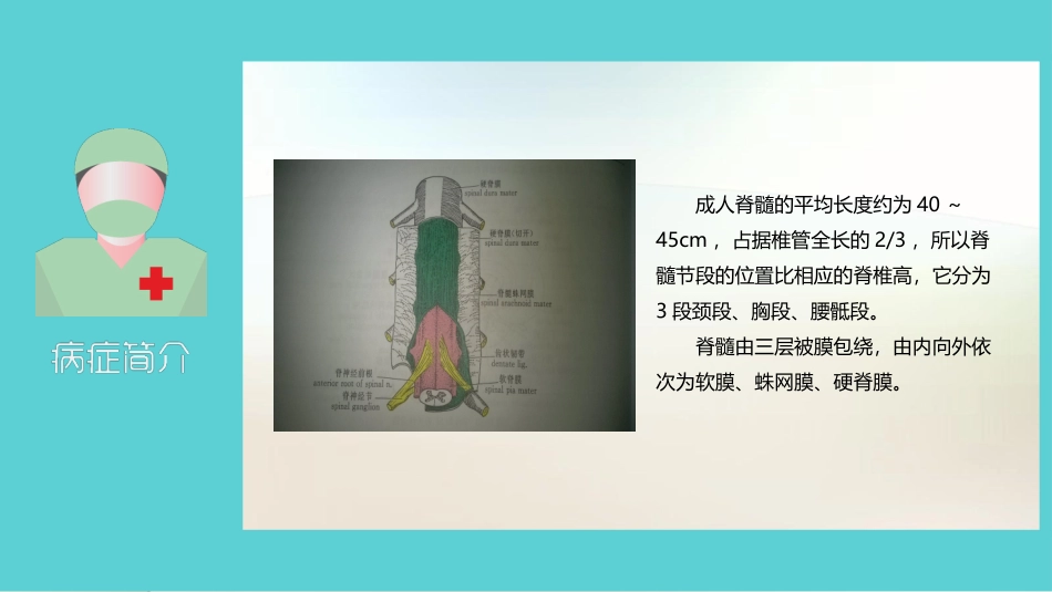 椎管内占位课件_第3页